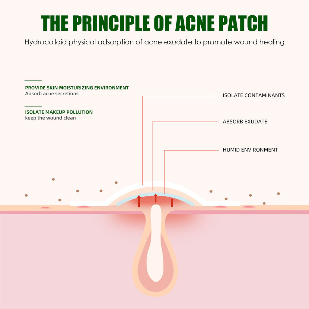 Parches Anti-Acné Absorbentes