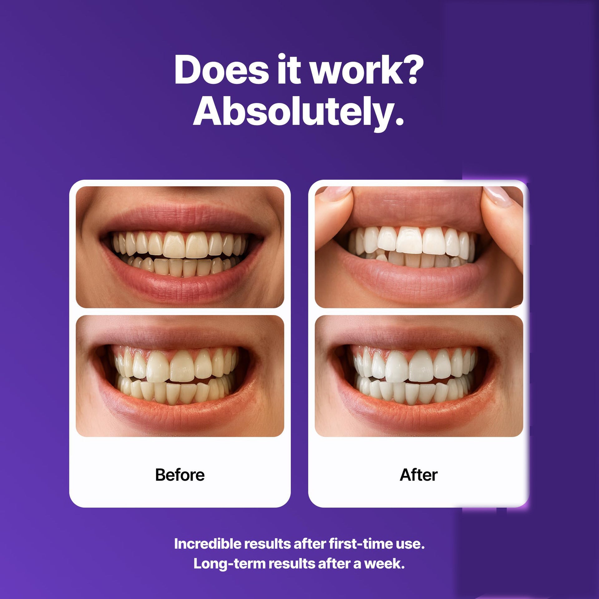 Tiras Blanqueadoras Dentales